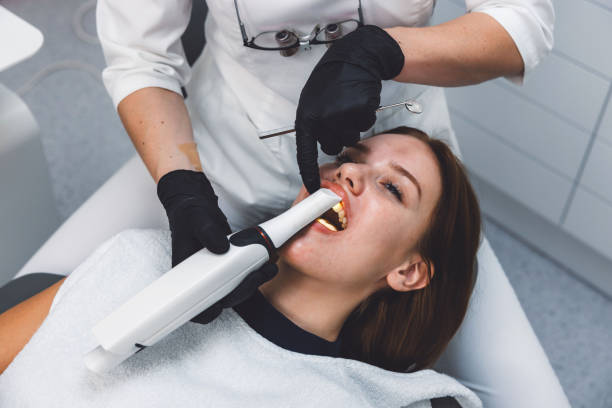 Best Knocked-Out Tooth (Avulsed Tooth) Treatment in Lake Delta, NY